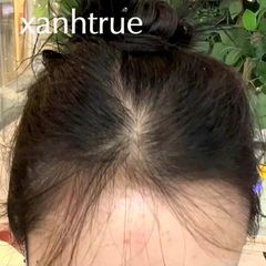 Ảnh khách gửi: Trước