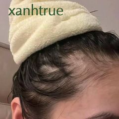 Ảnh khách gửi: Trước