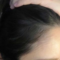 Ảnh khách gửi: Sau