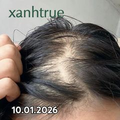 Ảnh khách gửi: 10/01