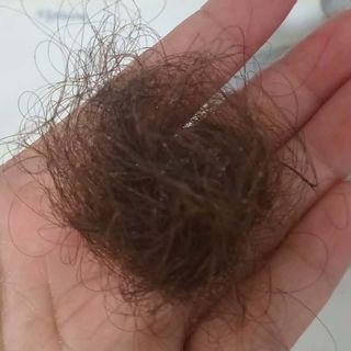 Tóc rụng sau khi gội