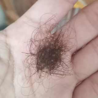 Tóc rụng sau khi gội