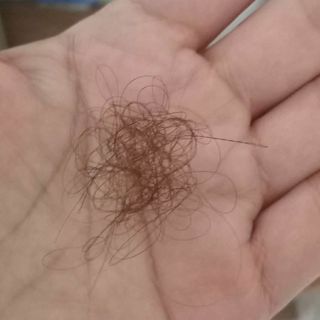 Tóc rụng sau khi gội