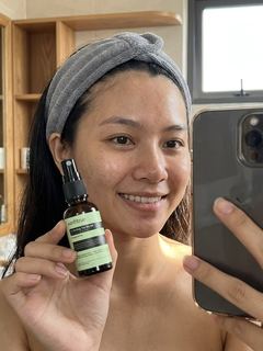 Ảnh minh hoạ dùng Xịt Mã Đề