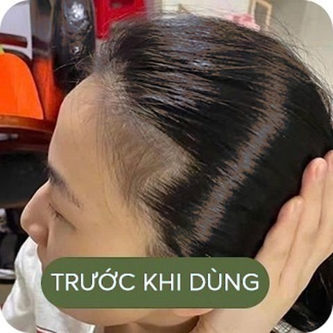 Trước khi dùng