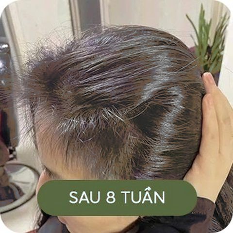 Sau 8 tuần