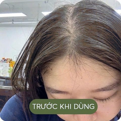 Trước khi dùng