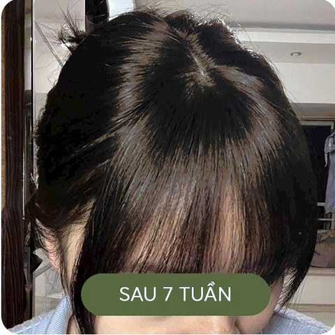 Sau 7 tuần