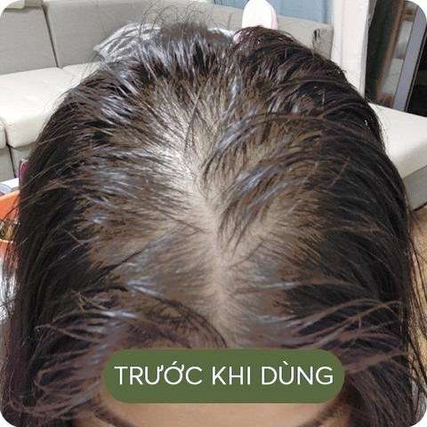 Trước khi dùng