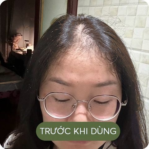 Trước khi dùng